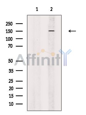 ATRN Antibody - Western blot analysis of extracts from Mouse brain, using ATRN Antibody.