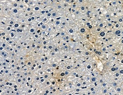 SRMS Antibody - DF2682 at 1/100 staining mouse liver tissue by IHC-P.