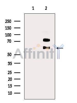 SRMS Antibody - Western blot analysis of extracts from MCF7 cells(serum starvation treatment), using SRMS Antibody.