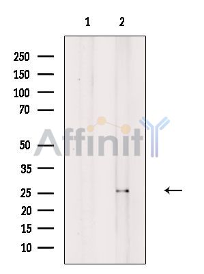 KLK12 Antibody - Western blot analysis of extracts from VERO cells(H2O2 treatment), using KLK12 Antibody.