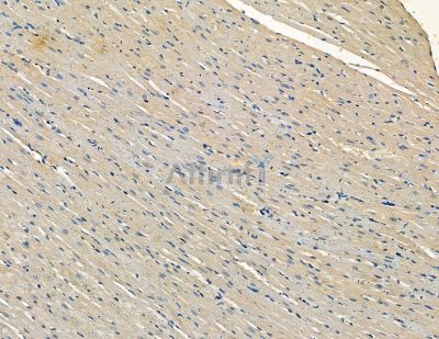 GPR22 Antibody - DF2732 at 1/100 staining rat heart tissue by IHC-P.