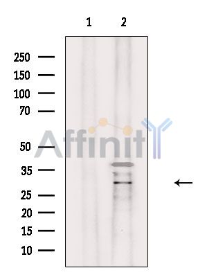 ABHD14A Antibody - Western blot analysis of extracts from Mouse brain, using ABHD14A Antibody.