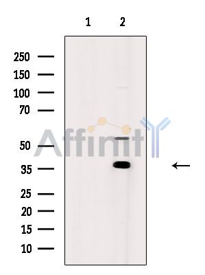 AKR1C2 Antibody - Western blot analysis of extracts from A549 cells, using AKR1C2 Antibody.