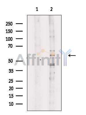 BEND4 Antibody - Western blot analysis of extracts from Rat testis, using BEND4 Antibody.