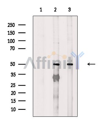 FOXN4 Antibody - Western blot analysis of extracts from various samples, using FOXN4 Antibody.