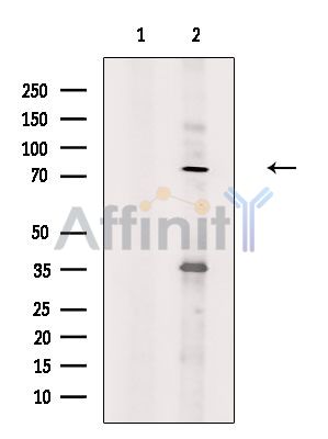 MAP9 Antibody - Western blot analysis of extracts from PC12 cells(H2O2 treatment), using MAP9 Antibody.