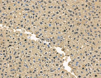 ZFP106 Antibody - DF8630 at 1/100 staining mouse liver tissue by IHC-P.