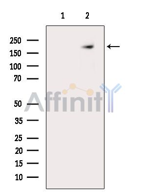 ZFP106 Antibody - Western blot analysis of extracts from MCF7 cells(serum starvation treatment), using ZFP106 Antibody.