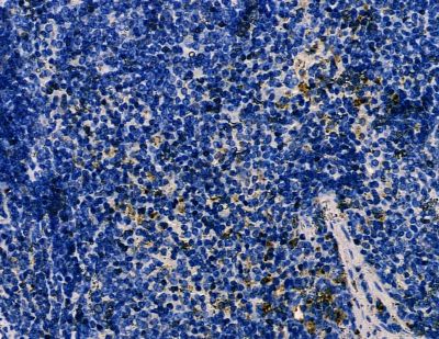 ZFP598 Antibody - DF8631 at 1/100 staining mouse spleen tissue by IHC-P.