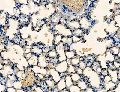 DIL-2 Antibody - DF8650 at 1/100 staining mouse lung tissue by IHC-P.