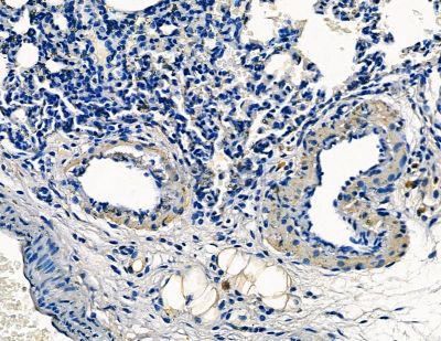 DIL-2 Antibody - DF8650 at 1/100 staining rat lung tissue by IHC-P.