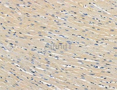FHL3 Antibody - DF8826 at 1/100 staining rat heart tissue by IHC-P.
