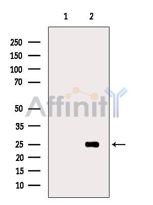 FHL3 Antibody - Western blot analysis of extracts from Rat heart, using FHL3 Antibody.