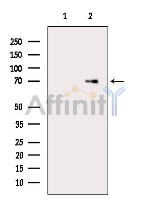 PLXDC2 Antibody - Western blot analysis of extracts from MCF7 cells(serum starvation treatment), using PLXDC2 Antibody.