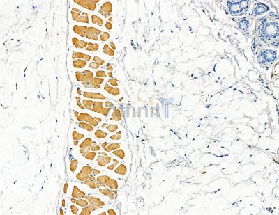AKAP11 Antibody - DF8884 at 1/100 staining mouse skin tissue by IHC-P.