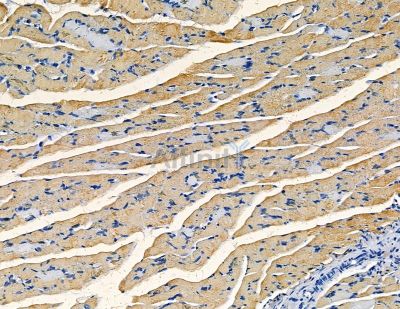 AKAP11 Antibody - DF8884 at 1/100 staining rat muscle tissue by IHC-P.
