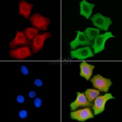 CD320 Antibody - DF8910 staining HepG2 cells by IF/ICC.