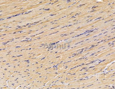 FGFBP3 Antibody - DF8950 at 1/100 staining rat muscle tissue by IHC-P.