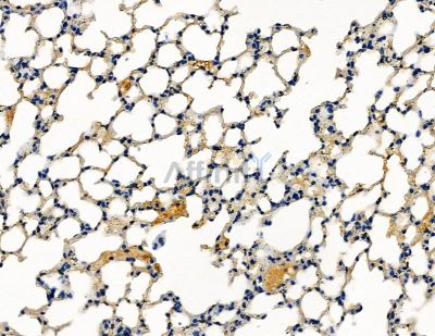 CENPK Antibody - DF9059 at 1/100 staining mouse lung tissue by IHC-P.