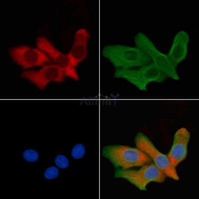 AQP6 Antibody - DF9223 staining HepG2 cells by IF/ICC.