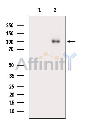 ATP2C2 Antibody - Western blot analysis of extracts from MCF7 cells(serum starvation treatment), using ATP2C2 Antibody.