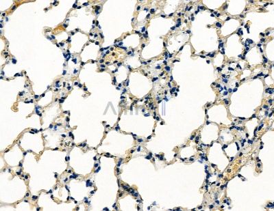 CAPN13 Antibody - DF9319 at 1/100 staining mouse lung tissue by IHC-P.