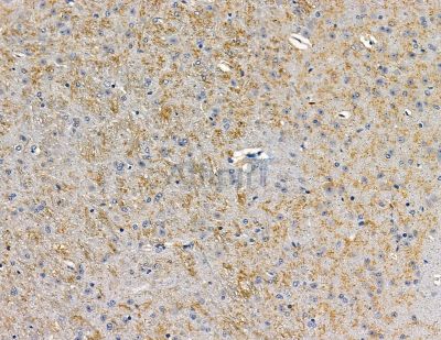 CEP63 Antibody - DF9363 at 1/100 staining mouse brain tissue by IHC-P.