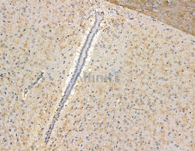 CEP63 Antibody - DF9363 at 1/100 staining rat brain tissue by IHC-P.