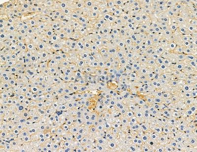 CSPP1 Antibody - DF9366 at 1/100 staining mouse skin tissue by IHC-P.
