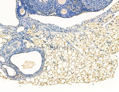 PDE3B Antibody - DF9372 at 1/100 staining rat muscle tissue by IHC-P.