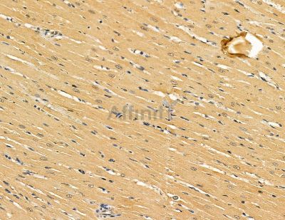 DOCK11 Antibody - DF9432 at 1/100 staining rat heart tissue by IHC-P.