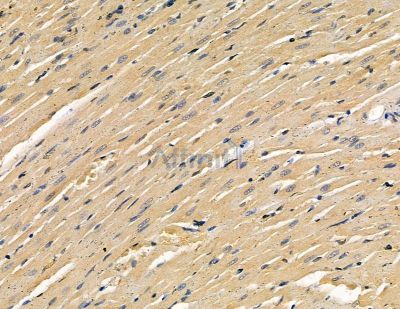 TOP1MT Antibody - DF9452 at 1/100 staining rat heart tissue by IHC-P.