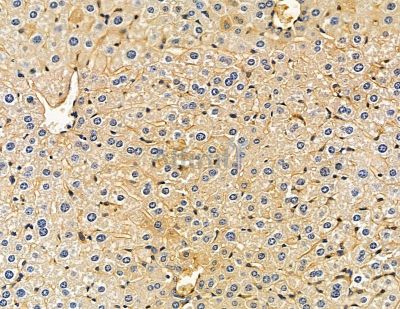 HSD17B12 Antibody - DF9505 at 1/100 staining mouse liver tissue by IHC-P.