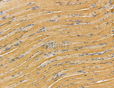 HSD17B12 Antibody - DF9505 at 1/100 staining rat muscle tissue by IHC-P.