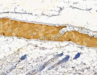 HSD17B12 Antibody - DF9505 at 1/100 staining rat skin tissue by IHC-P.