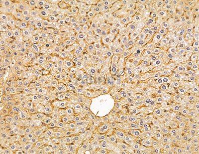 HLA-DQB2 Antibody - DF9574 at 1/100 staining mouse liver tissue by IHC-P.