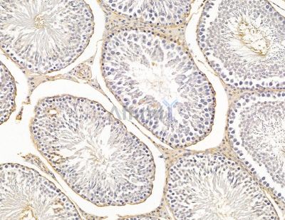 HLA-DQB2 Antibody - DF9574 at 1/100 staining rat testis tissue by IHC-P.