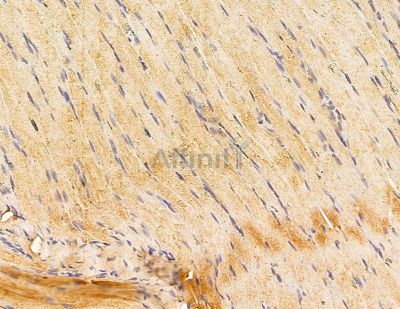 HLA-DQB2 Antibody - DF9574 at 1/100 staining rat muscle tissue by IHC-P.