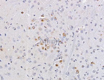 MT-ND2 Antibody - DF9674 at 1/100 staining rat brain tissue by IHC-P.