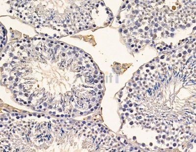 RABL2B Antibody - DF9797 at 1/100 staining mouse testis tissue by IHC-P.