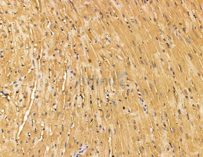 RAPH1 Antibody - DF9806 at 1/100 staining mouse heart tissue by IHC-P.