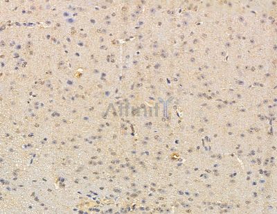RASGEF1A Antibody - DF9807 at 1/100 staining mouse brain tissue by IHC-P.