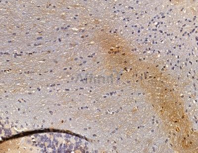 RGS17 Antibody - DF9844 at 1/100 staining mouse brain tissue by IHC-P.