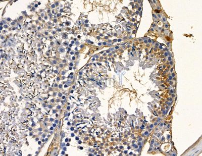 ABCA4 Antibody - DF9852 at 1/100 staining mouse testis tissue by IHC-P.
