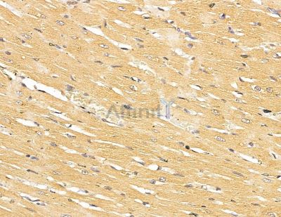 SCARA3 Antibody - DF9878 at 1/100 staining rat heart tissue by IHC-P.