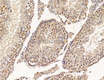 VRK1 Antibody - DF9892 at 1/100 staining mouse testis tissue by IHC-P.