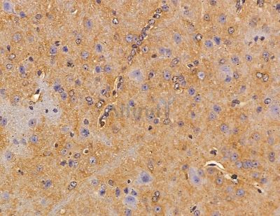 SH3BGRL1 Antibody - DF9906 at 1/100 staining mouse brain tissue by IHC-P.