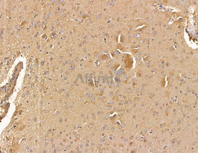 SH3BGRL1 Antibody - DF9906 at 1/100 staining rat brain tissue by IHC-P.