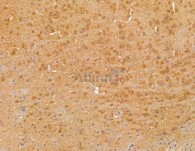 BTF3L4 Antibody - DF9974 at 1/100 staining mouse brain tissue by IHC-P.