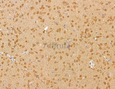 BTF3L4 Antibody - DF9974 at 1/100 staining rat brain tissue by IHC-P.